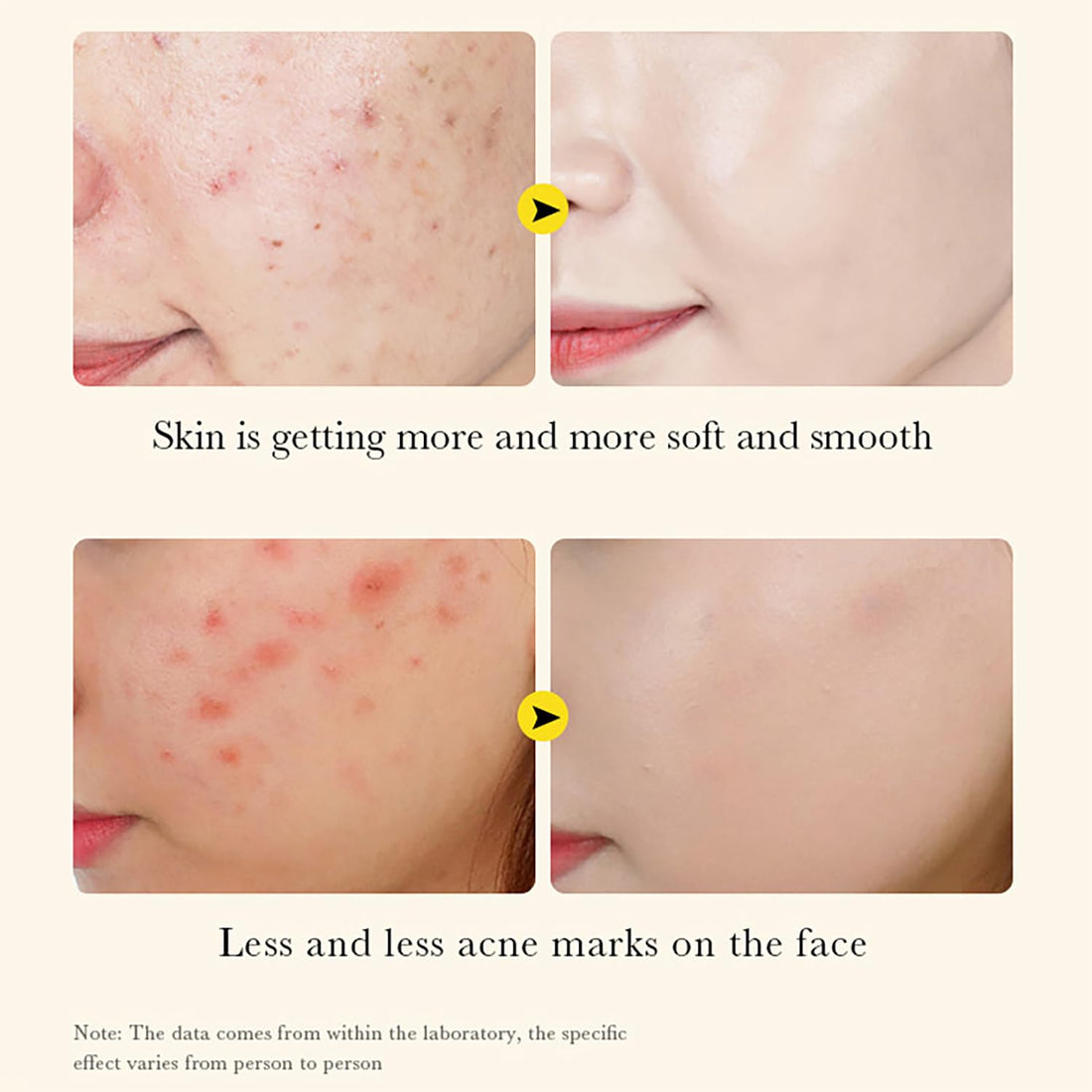 BIOAQUA Turmeric Facial Serum Acne Skin 30ml