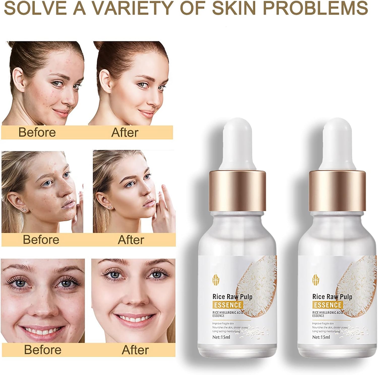 Rosarden Rice Raw Pulp Skin Care Set for Teenage Girls