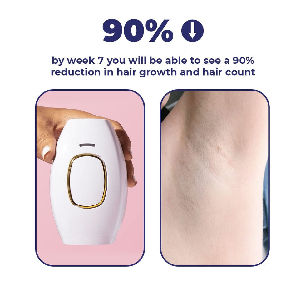 IPL Mini Laser Hair Removal for Men and Women